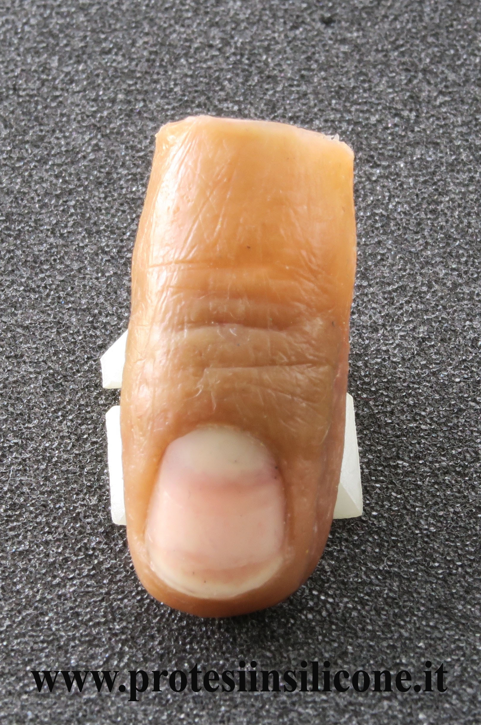 partial prosthesis of finger