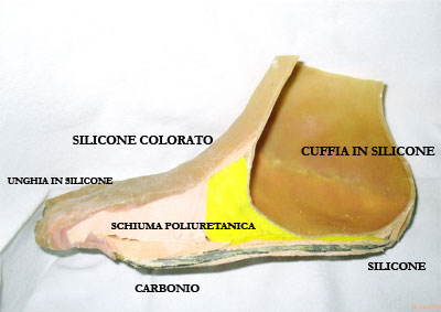 PROTESI DI PIEDE IN SILICONE ESTETICA E FUNZIONALE