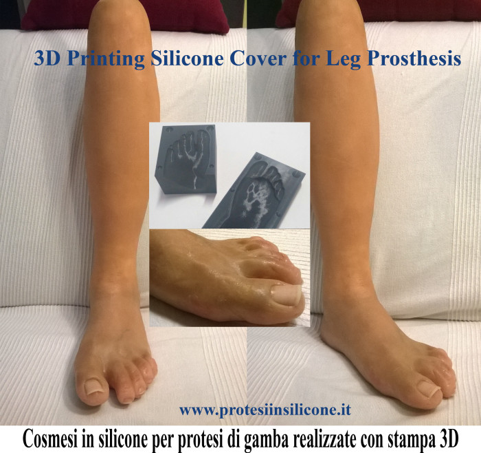 3D Printing Silicone Cosmesis